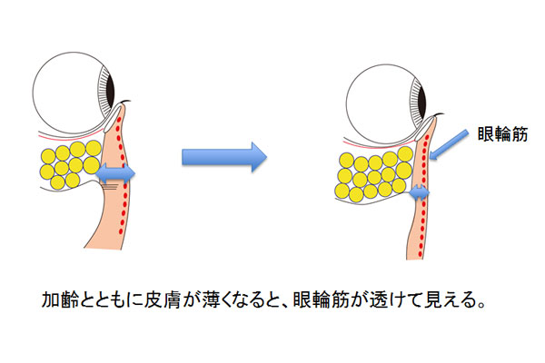 青ぐま