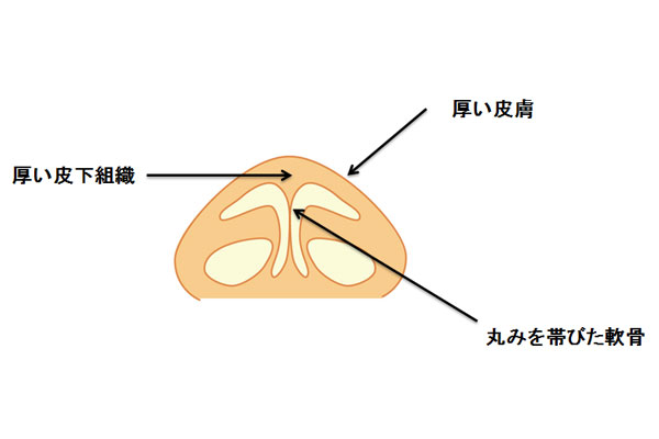 鼻尖形成