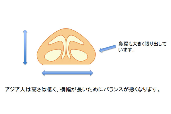 アジア人の鼻は高さが低く、横幅が長いためバランスが悪くなります