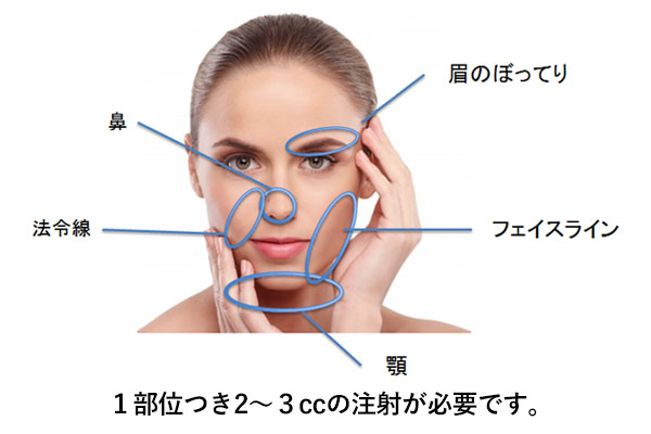 BNLS Neoは1部位につき2～3ccの注射が必要