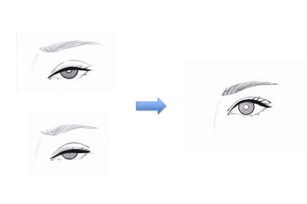眼瞼下垂の治療