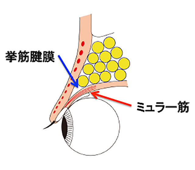 挙筋腱膜とミュラー筋